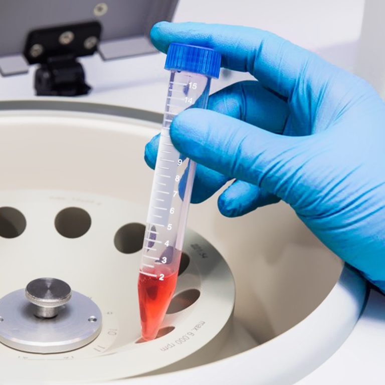 Sada Skúmaviek 15ml 500ks – Obrázok 6